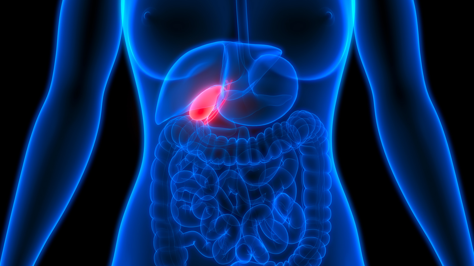 Ablation de la vésicule biliaire conséquences​