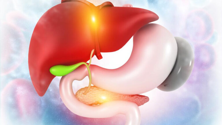 Ablation de la vésicule biliaire