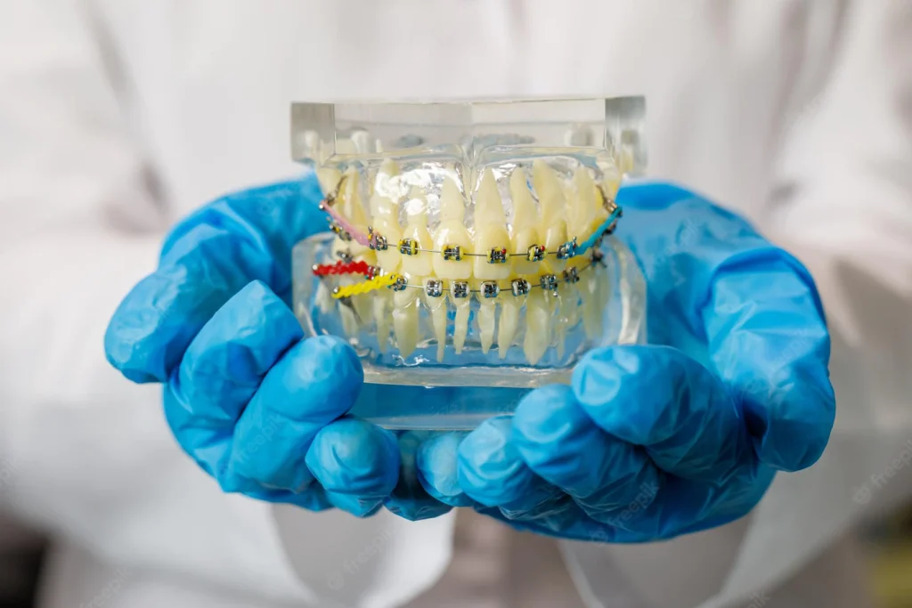 Couronnes dentaires prix : combien coute une couronne dentaire