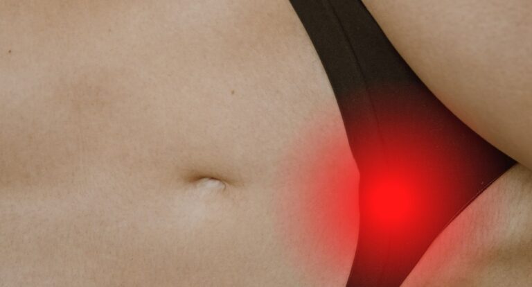 kyste sébacé pubis