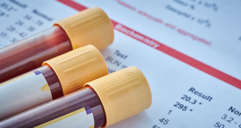 cpk élevé et fatigue